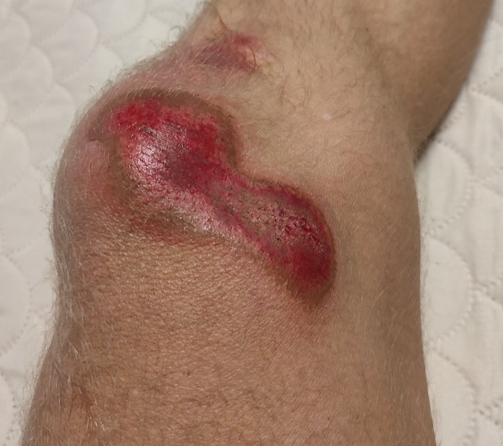 15. Veľmi blbý nápad.